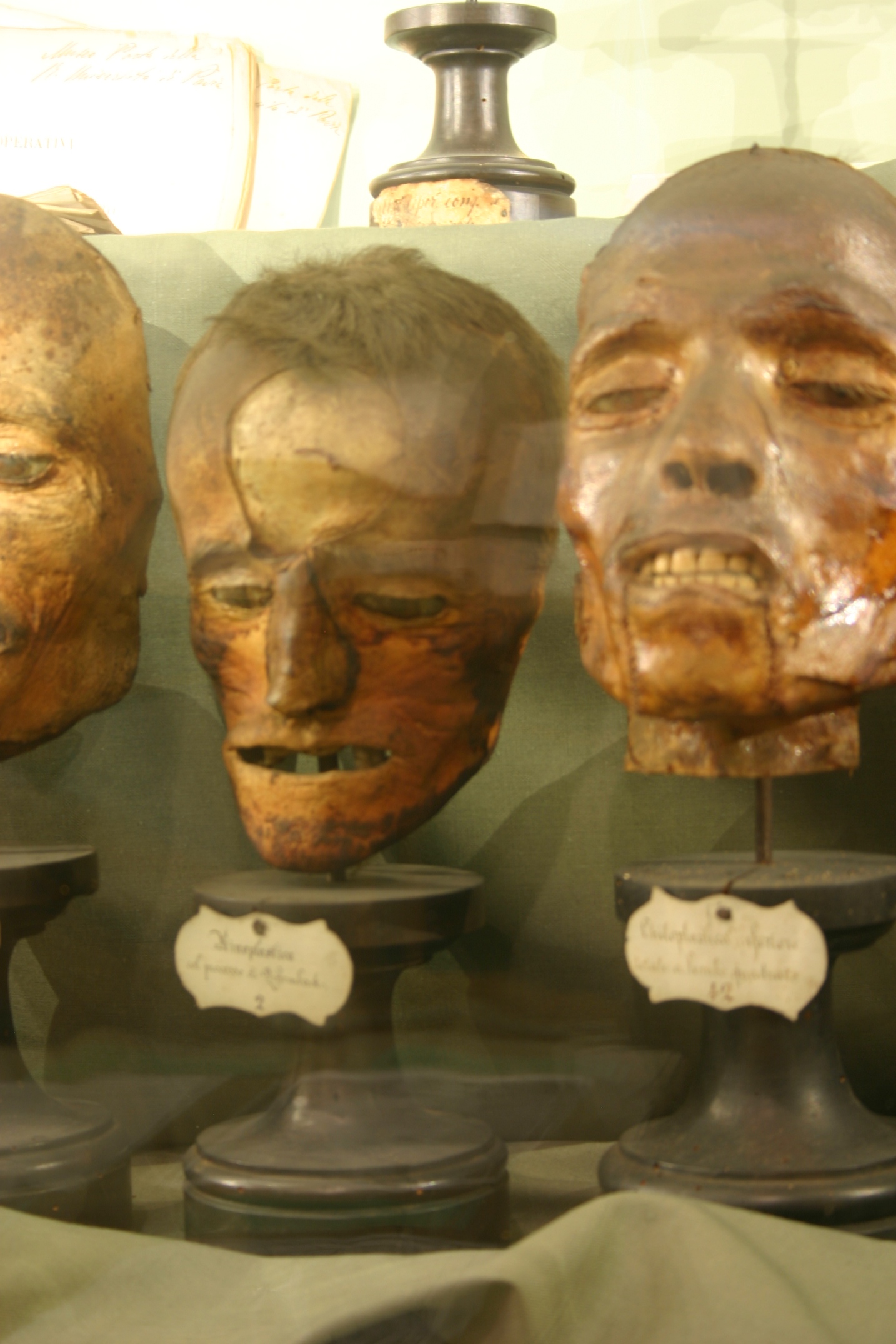 Rhinoplasty section of Luigi Porta anatomical collection, Museo per la Storia dell'Università, Pavia - 03.JPG